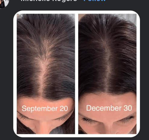 Before and after result 1 — Liquid BioCell user