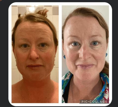 Before and after result 2 — Liquid BioCell user