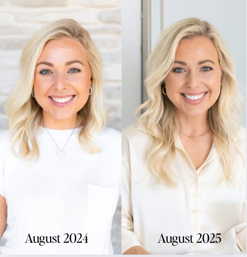 Before and after result 4 — Liquid BioCell user