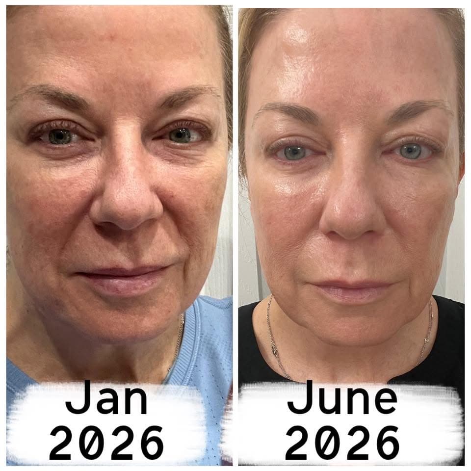 Before and after result 5 — Liquid BioCell user