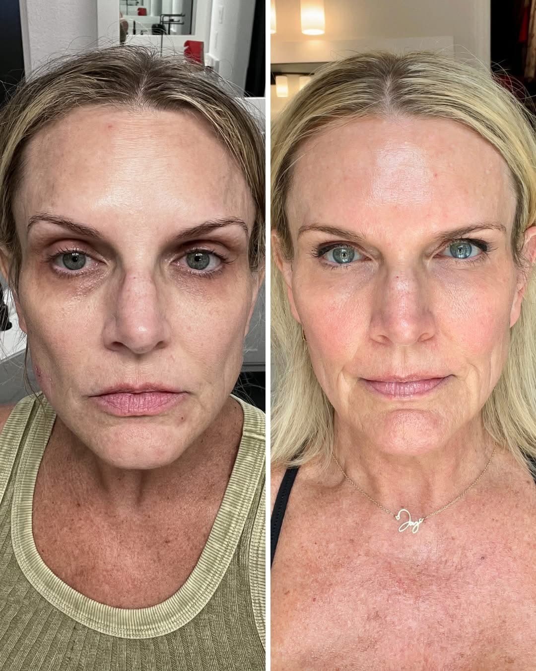 Before and after result 6 — Liquid BioCell user