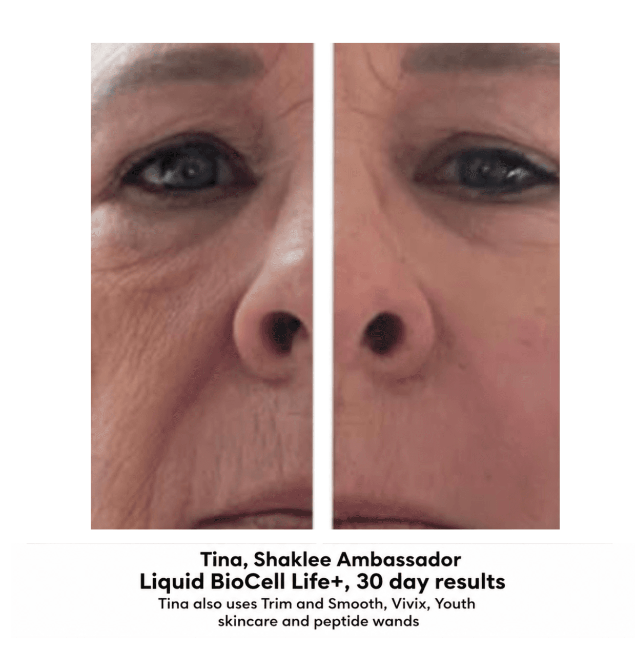 Before and after result 7 — Liquid BioCell user