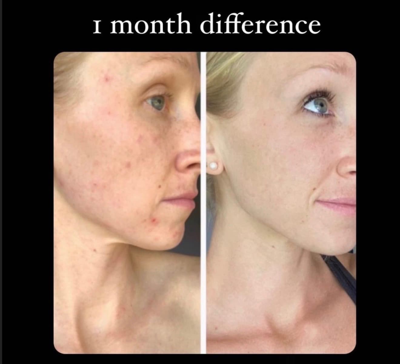 Before and after result 8 — Liquid BioCell user