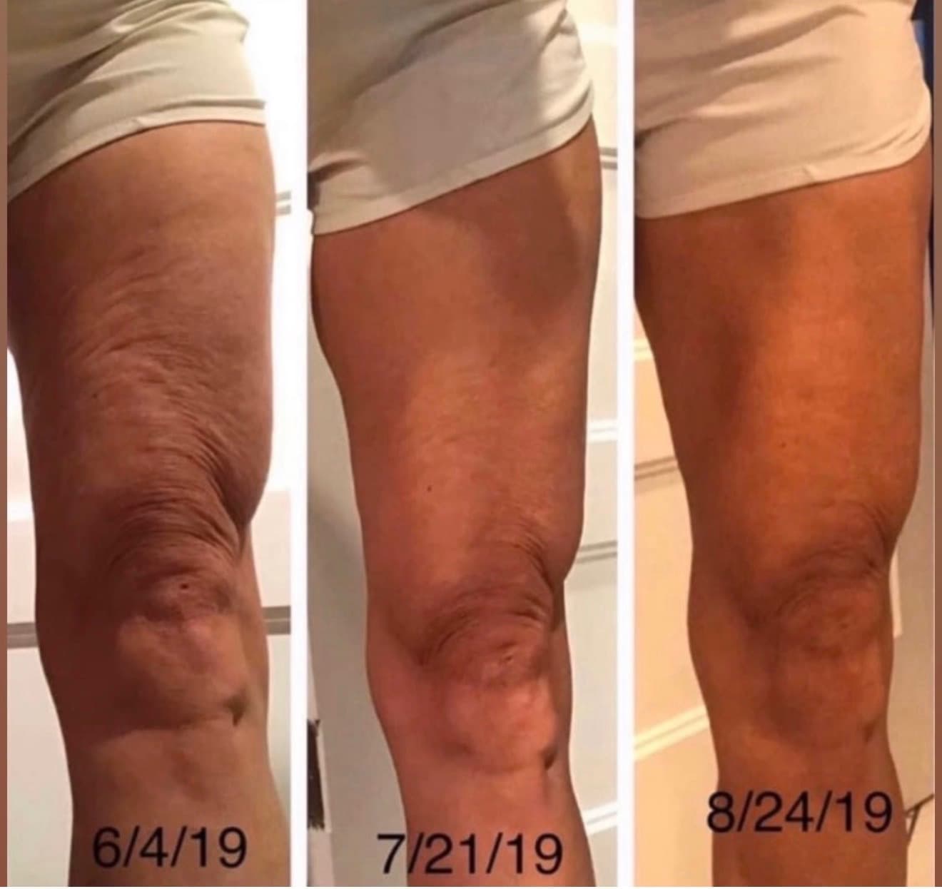 Before and after result 9 — Liquid BioCell user