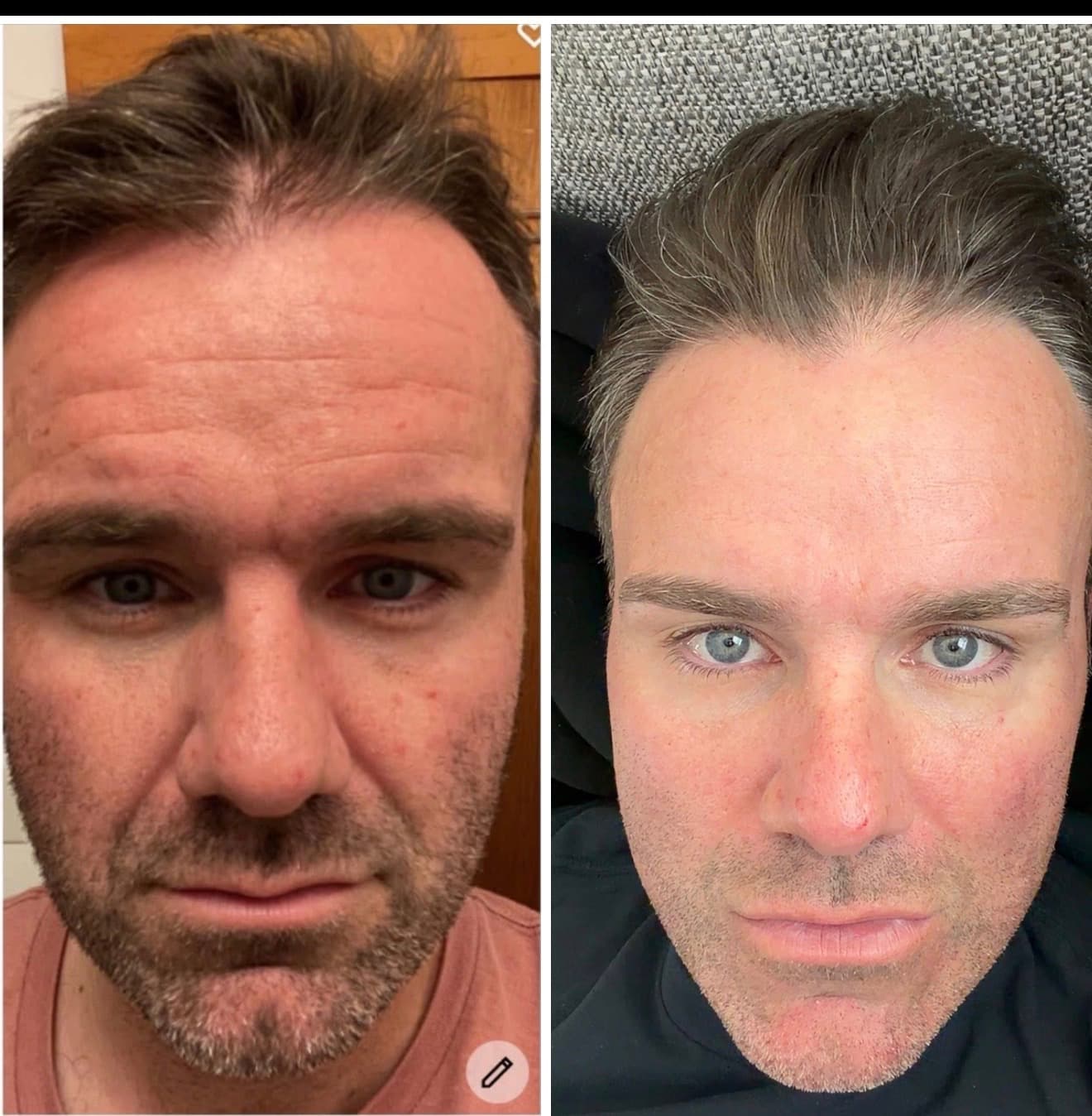 Before and after result 10 — Liquid BioCell user