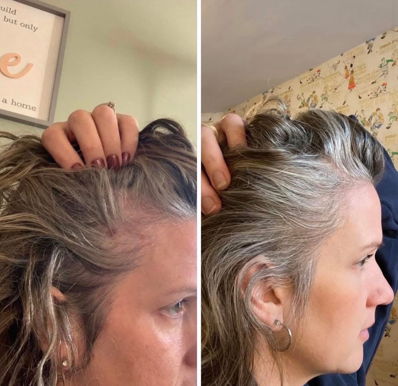 Before and after result 14 — Liquid BioCell user